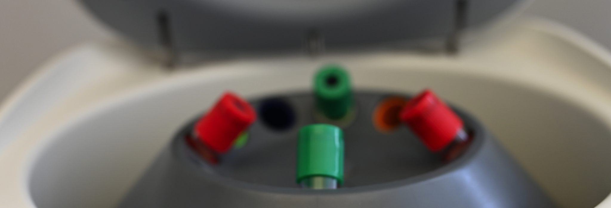 Heilungsbooster durch Eigenblut